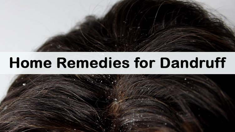 Dandruff