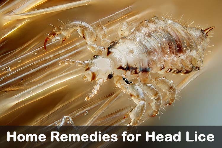 Headlice