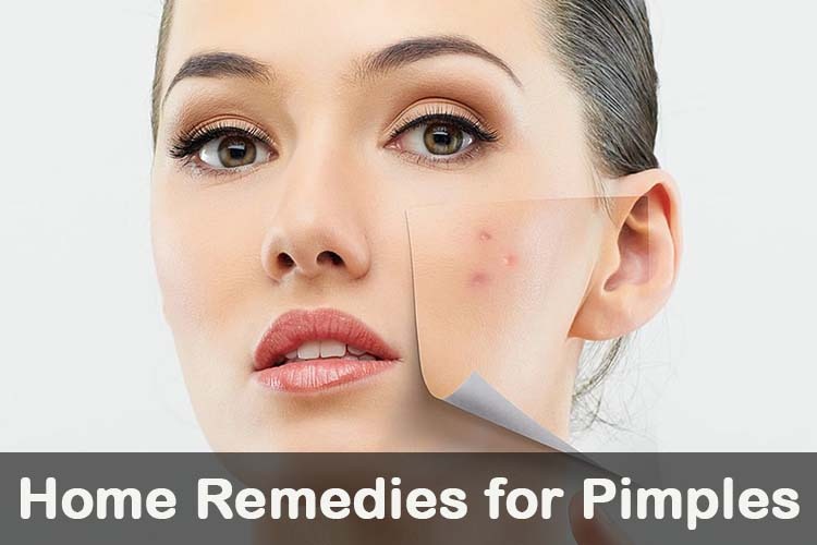 Pimples