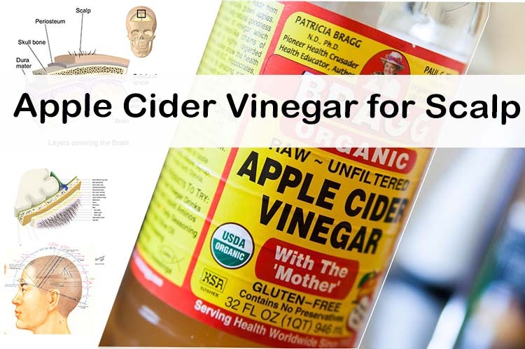 Apple Cider Vinegar for Scalp