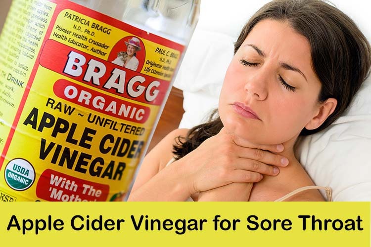 Apple Cider Vinegar for Sore Throat