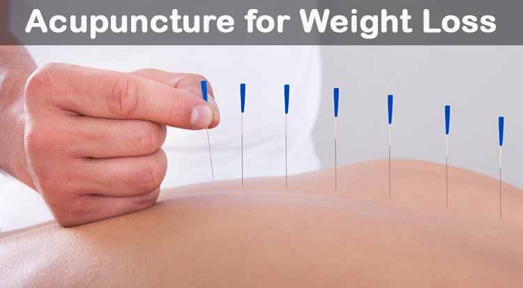 Acupuncture for Weight Loss