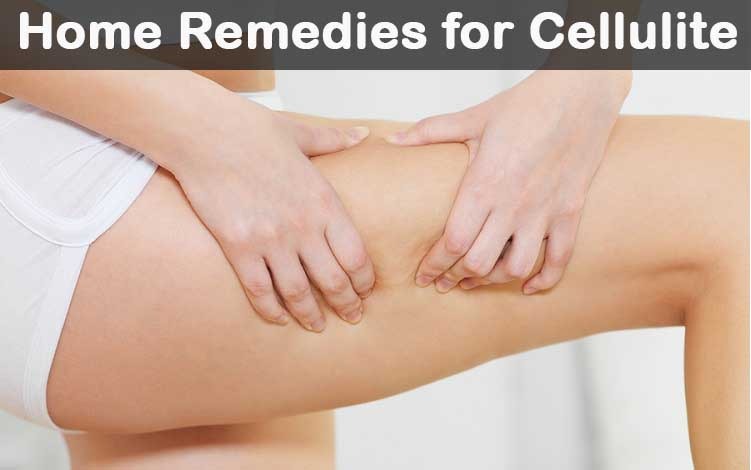 cellulite skin