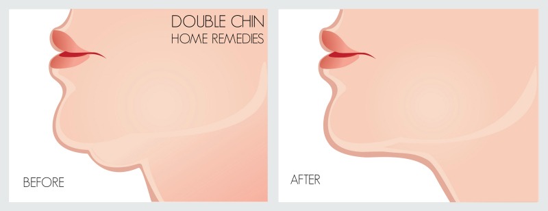 double chin home remedies