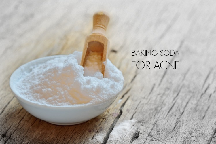 baking soda for acne