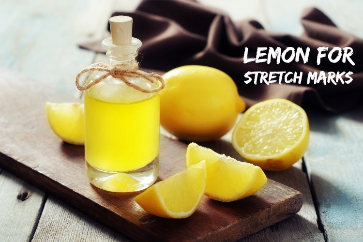 Lemon for Stretch Marks