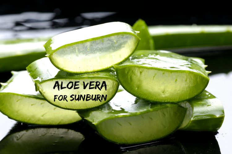 aloe vera for sunburn