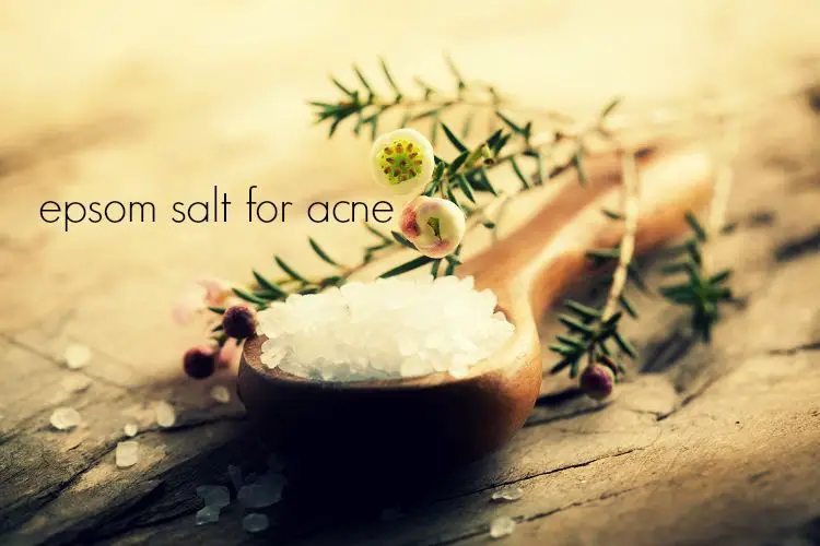 epsom salt for acne