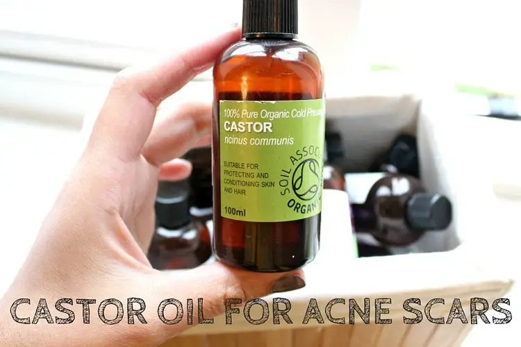 castor oil for acne scars