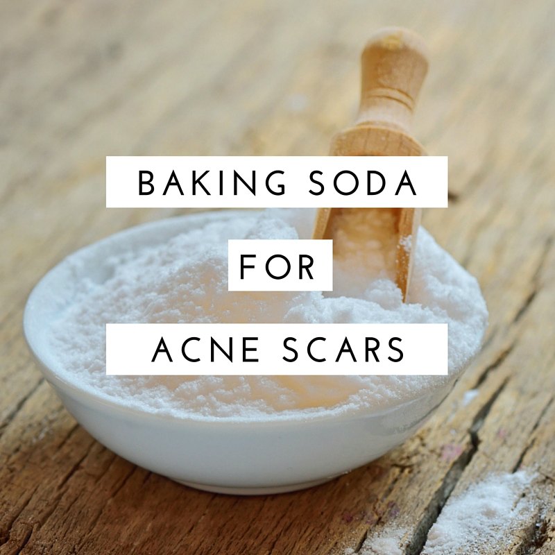12 DIY Home Remedies for Acne Scars Using Baking Soda Wellness.guide