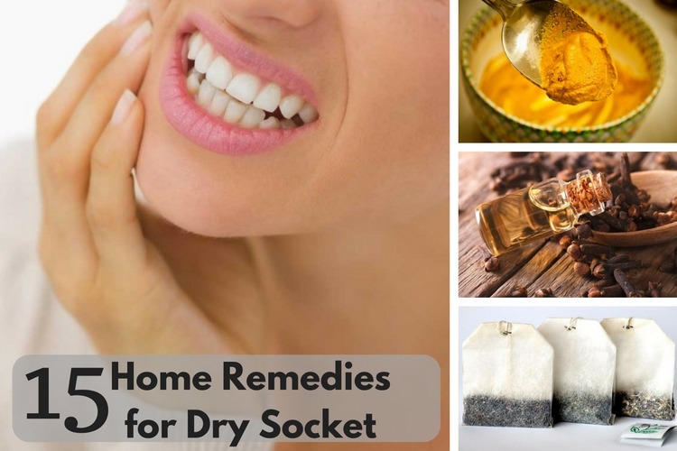 Home Remedies For Dry Socket