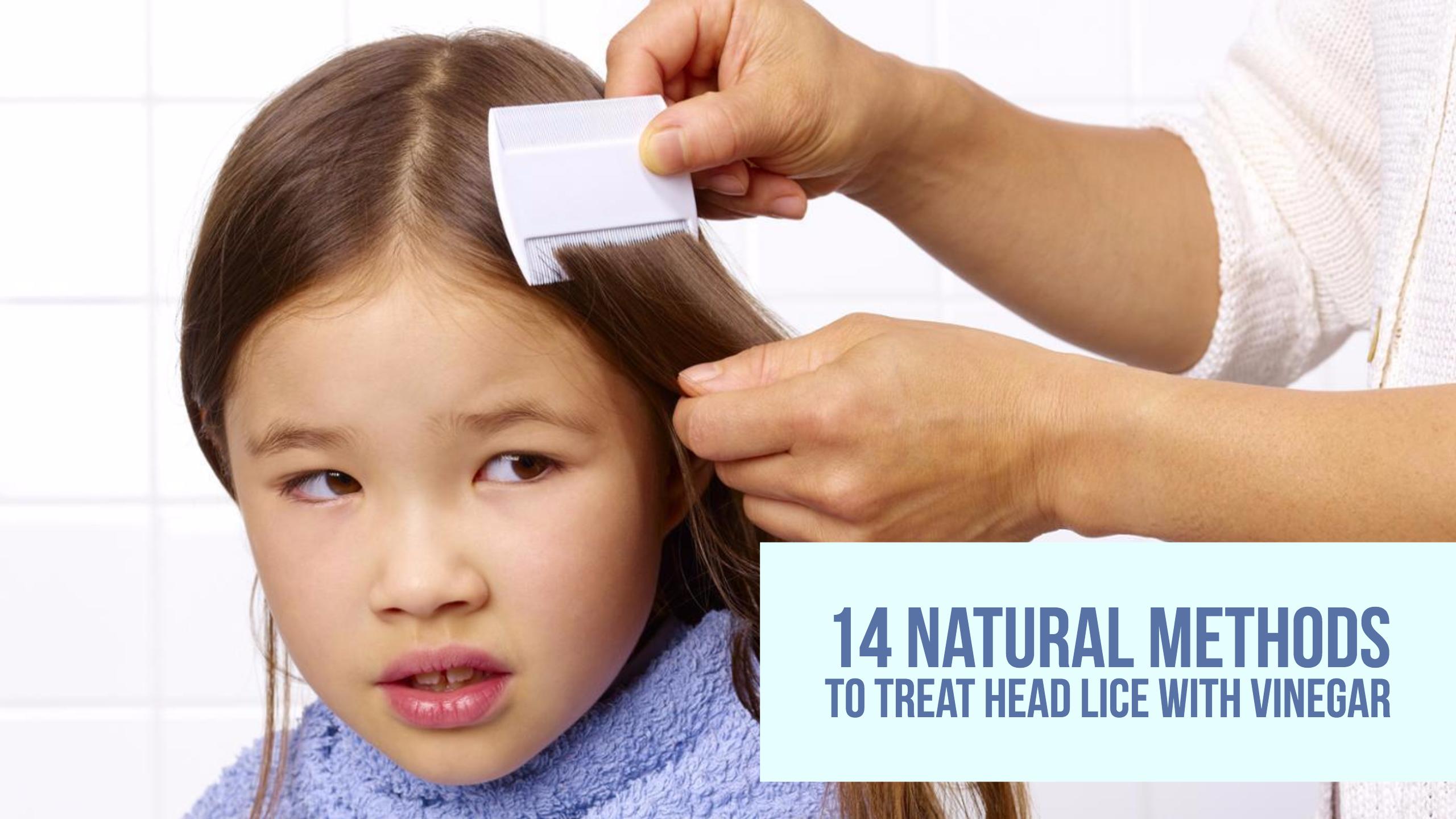 Vinegar For Head Lice