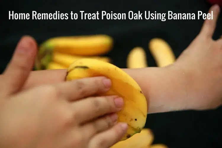 How to Use Banana Peel for Poison Oak
