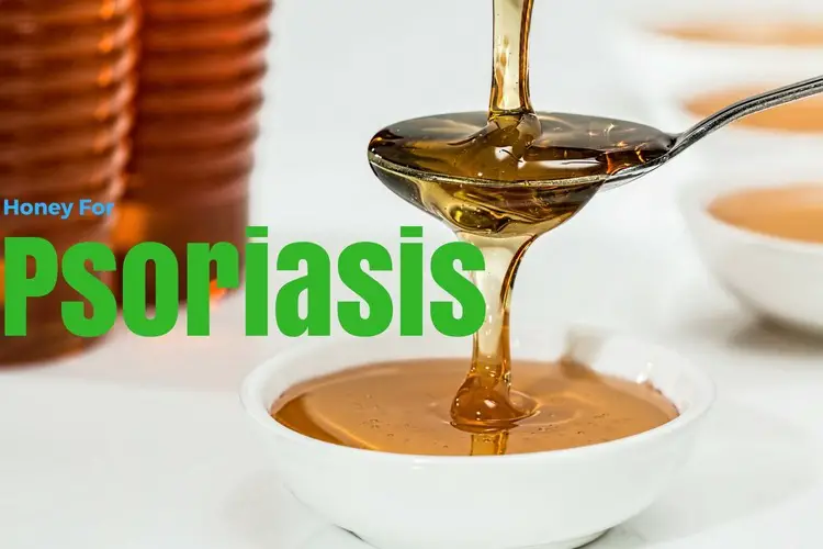 Honey For Psoriasis