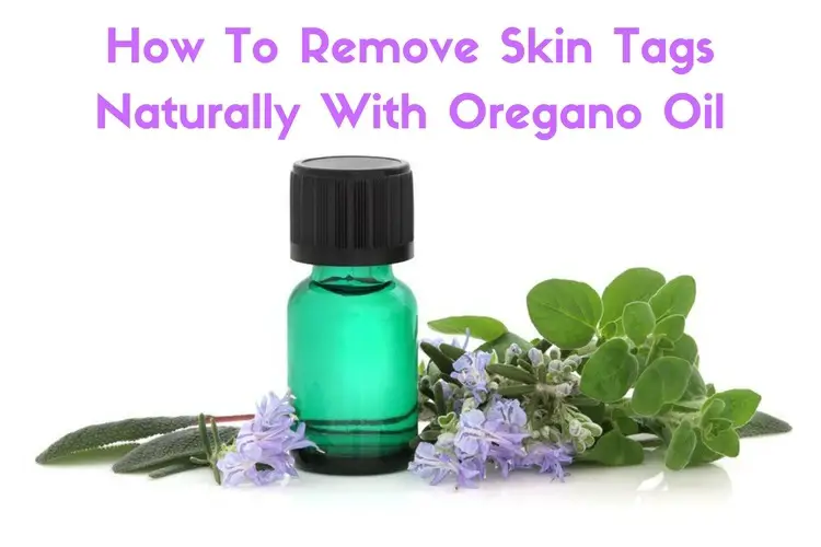 How to Use Oregano Oil for Skin Tags