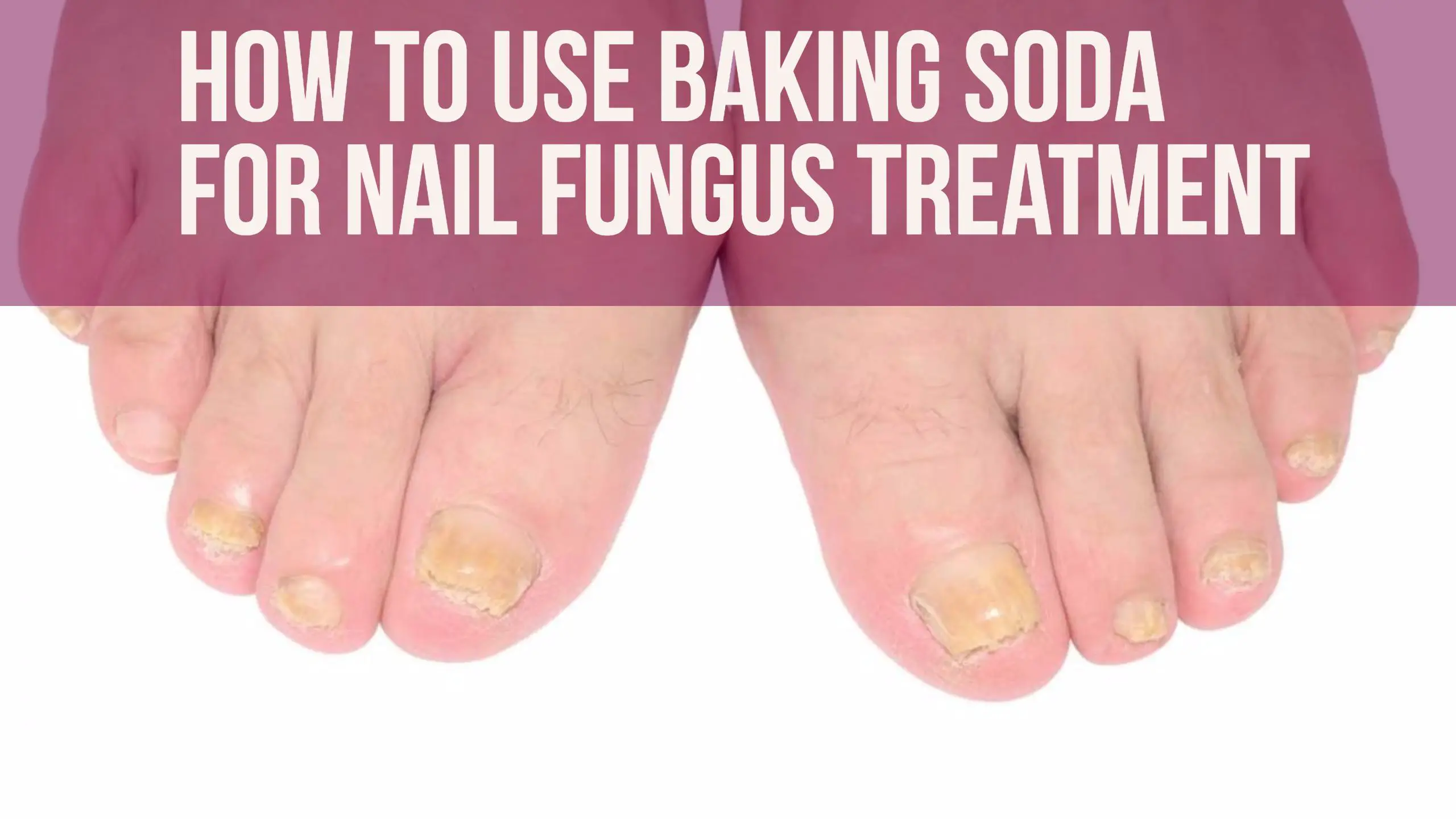 Baking Soda For Nail Fungus