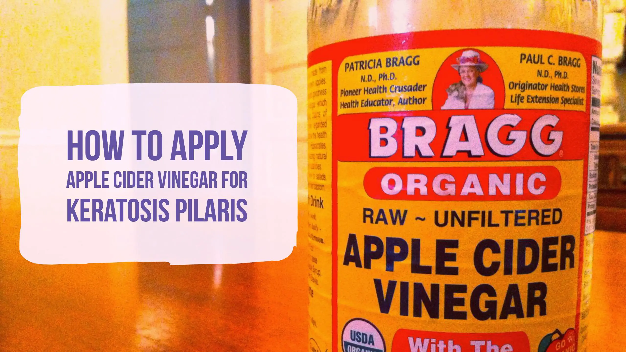 Apple Cider Vinegar For Keratosis Pilaris