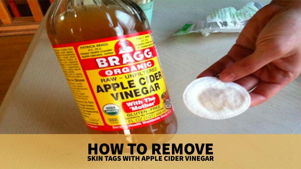 How to Remove Skin Tags with Apple Cider Vinegar? Wellness.guide