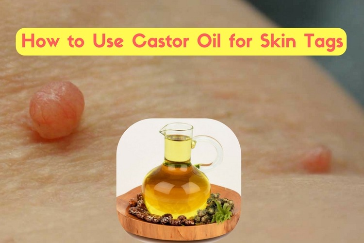 How To Use Castor Oil For Skin Tags 