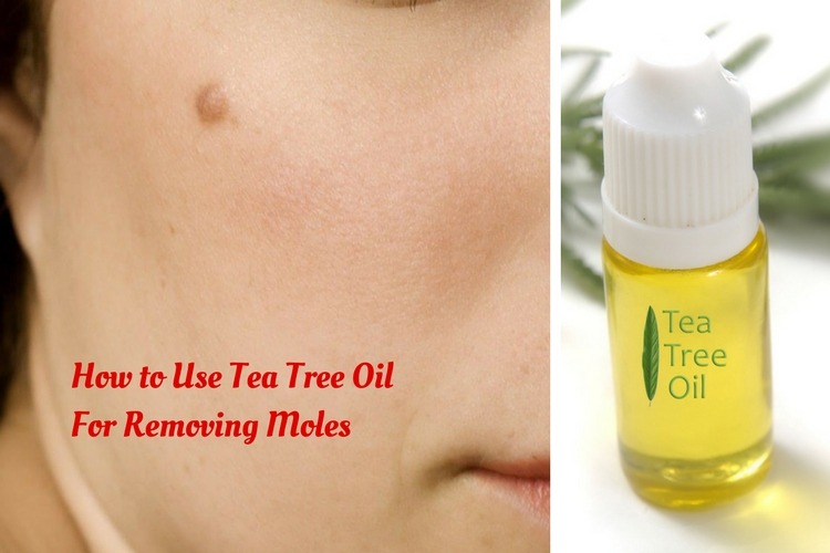 Does Tea Tree Oil Remove Moles