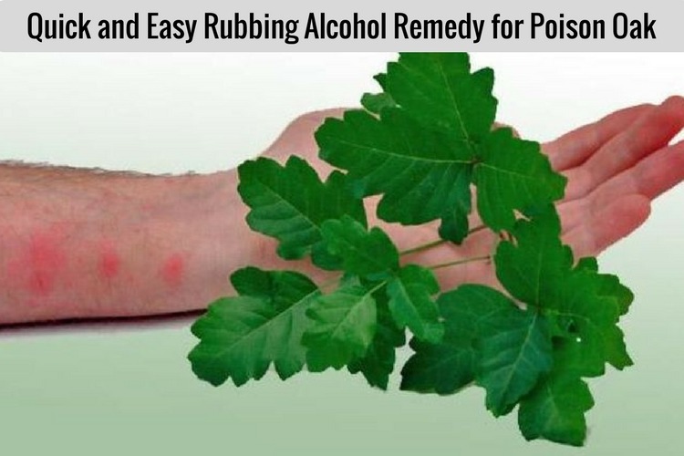 Poison Ivy, Oak And Sumac Rash Treatment, Anne Arundel, 46% OFF