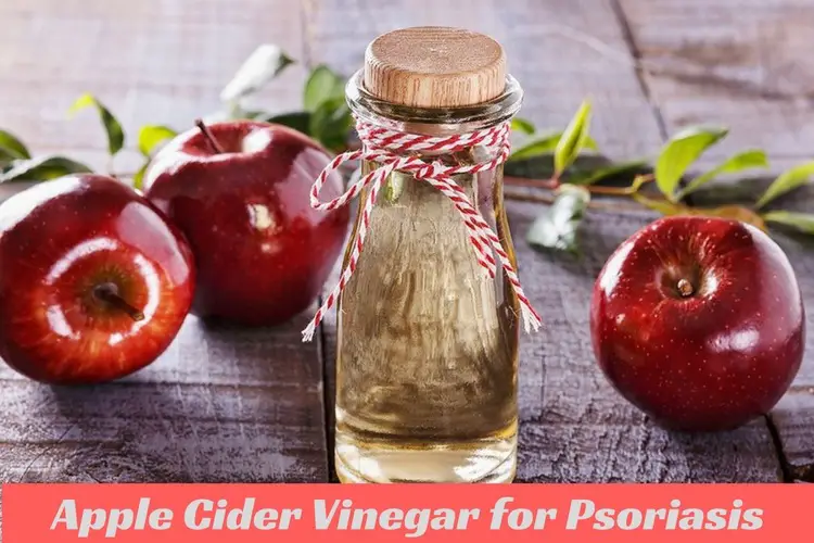 Apple Cider Vinegar For Psoriasis