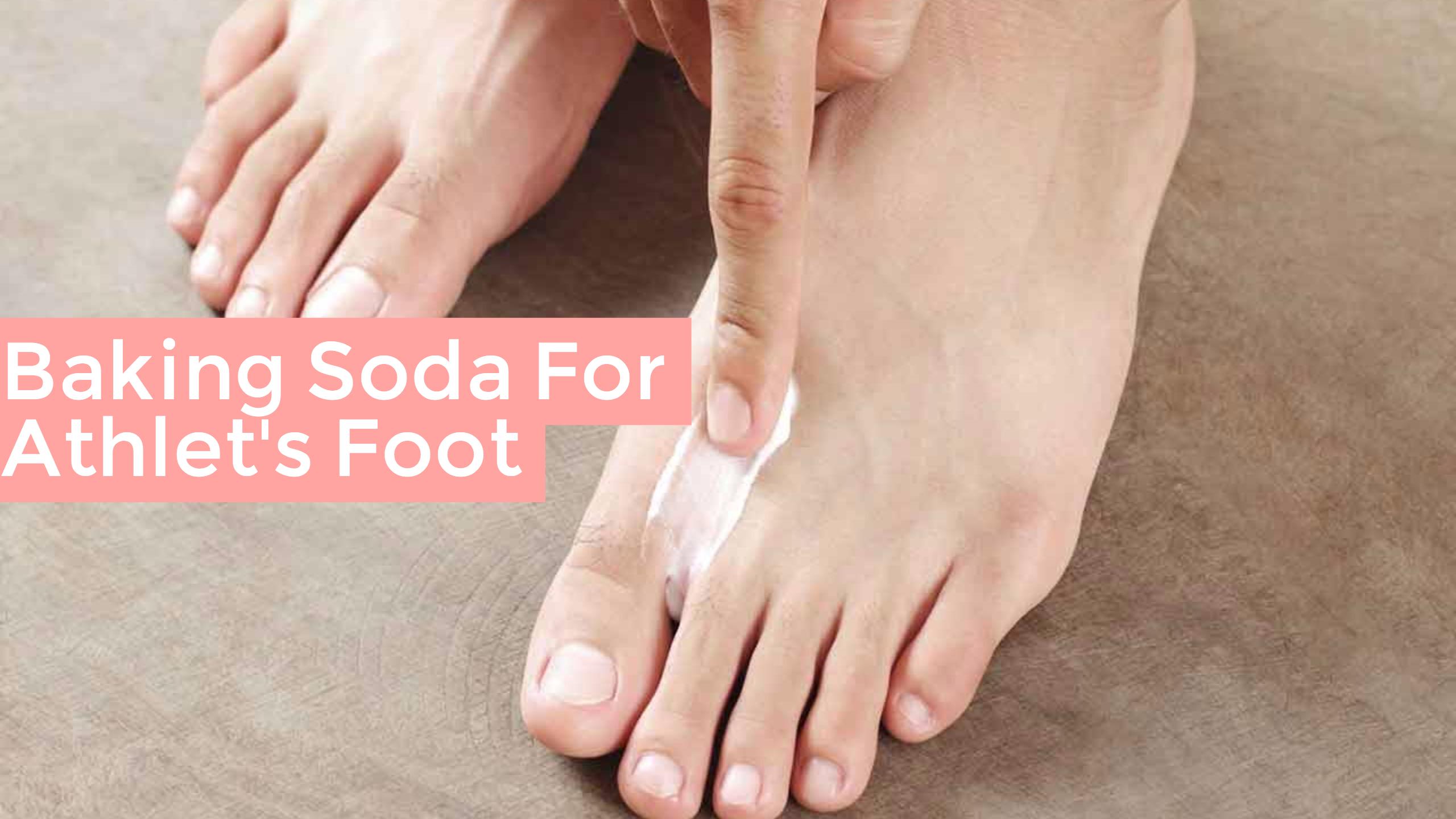 Baking Soda For Athletes Foot