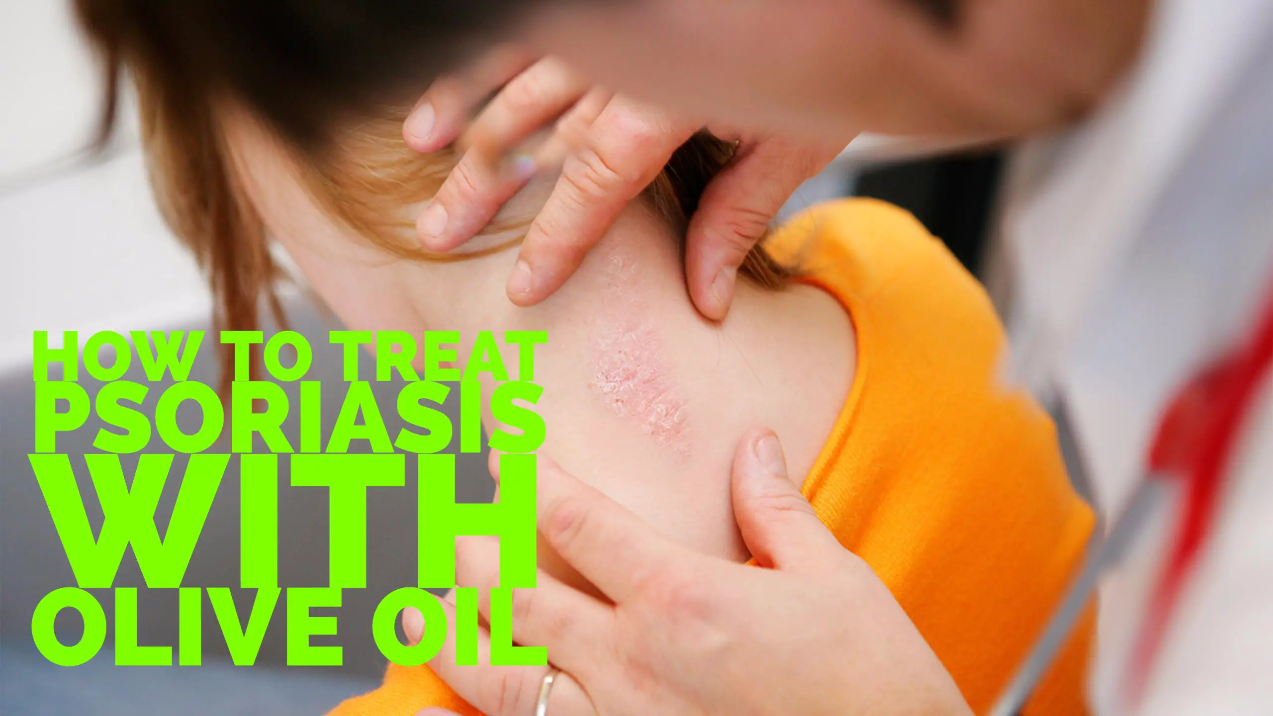 Olive Oil For Psoriasis