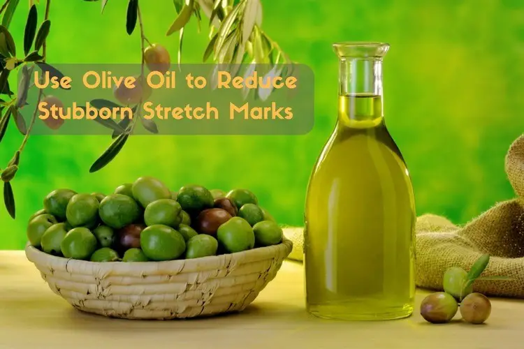 Use Olive Oil to Reduce Stubborn Stretch Marks (14 Methods) – Wellness ...