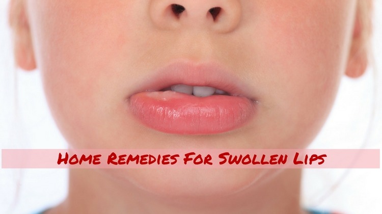 Home Remedies For Swollen Lips