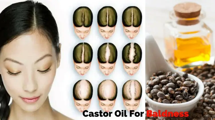 Get Rid of Baldness with Castor Oil