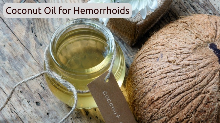 Coconut Oil for Hemorrhoids