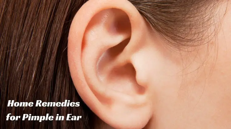 Home Remedies for Pimple in Ear