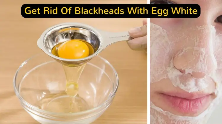 Egg Whites For Blackheads
