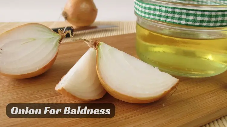 How to Use Onion to Get Rid of Baldness