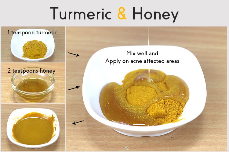 How to Treat Acne Effectively with Turmeric Wellness.guide