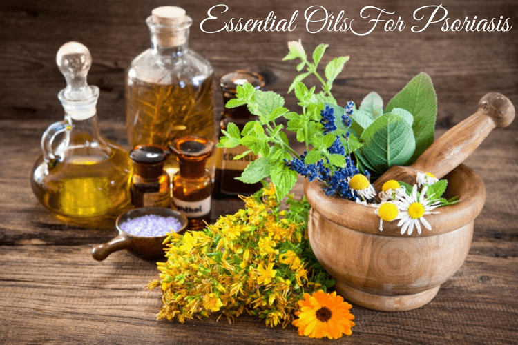 Essential Oils For Psoriasis