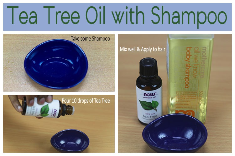 11 DIY Home Remedies for Head Lice Using Tea Tree Oil Wellness.guide