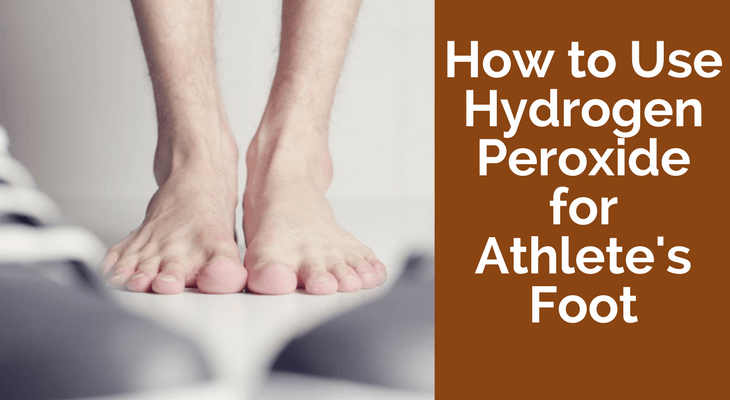 How to Use Hydrogen Peroxide for Athlete's Foot