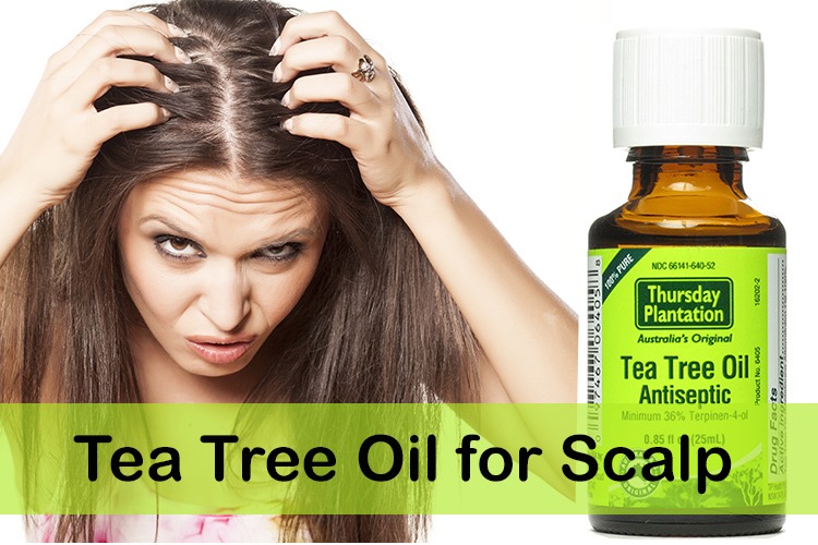 Tea Tree Oil For Dandruff