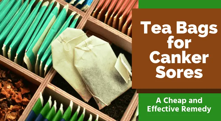 Tea Bags for Canker Sores
