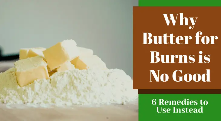 Why Butter for Burns is No Good