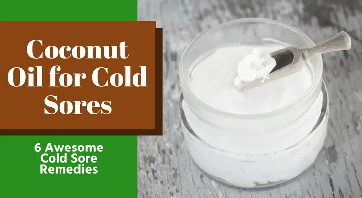 Coconut Oil for Cold Sores