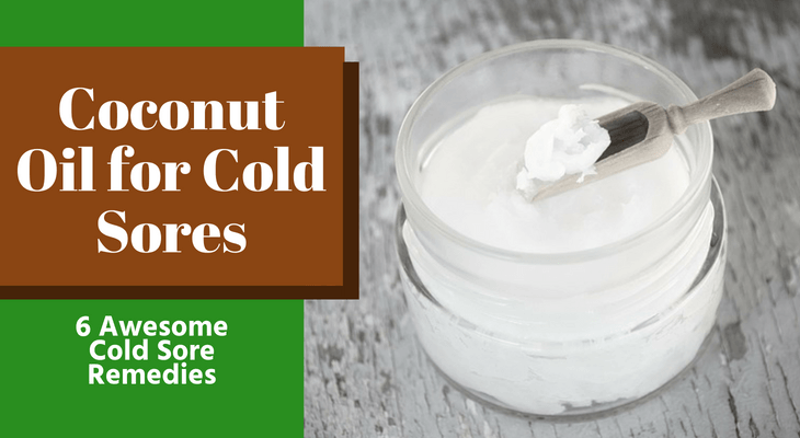 Coconut Oil for Cold Sores